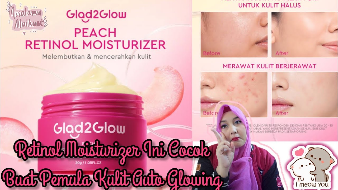 Review Jujur Aku Memakai Produk Glad2glow Retinol Moisturizer. Muka Tambah Glowing Dan Segar