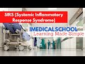 Sirs systemic inflammatory response syndrome made simple