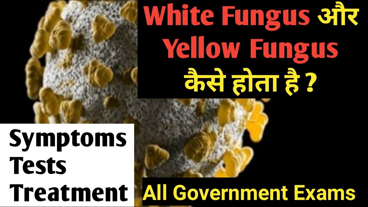 White Fungus & Yellow Fungus Kaise Hota Hai ? // Symptoms , Reasons