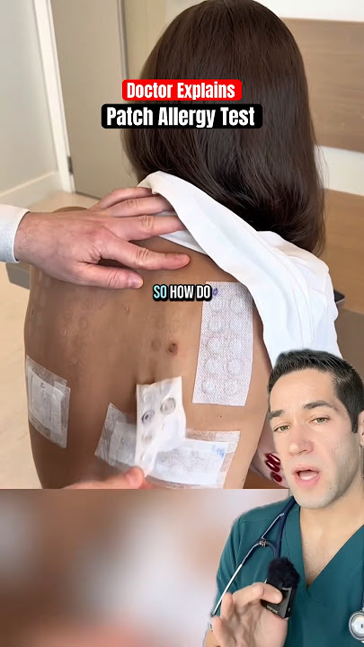 Doctor Explains: allergy test
