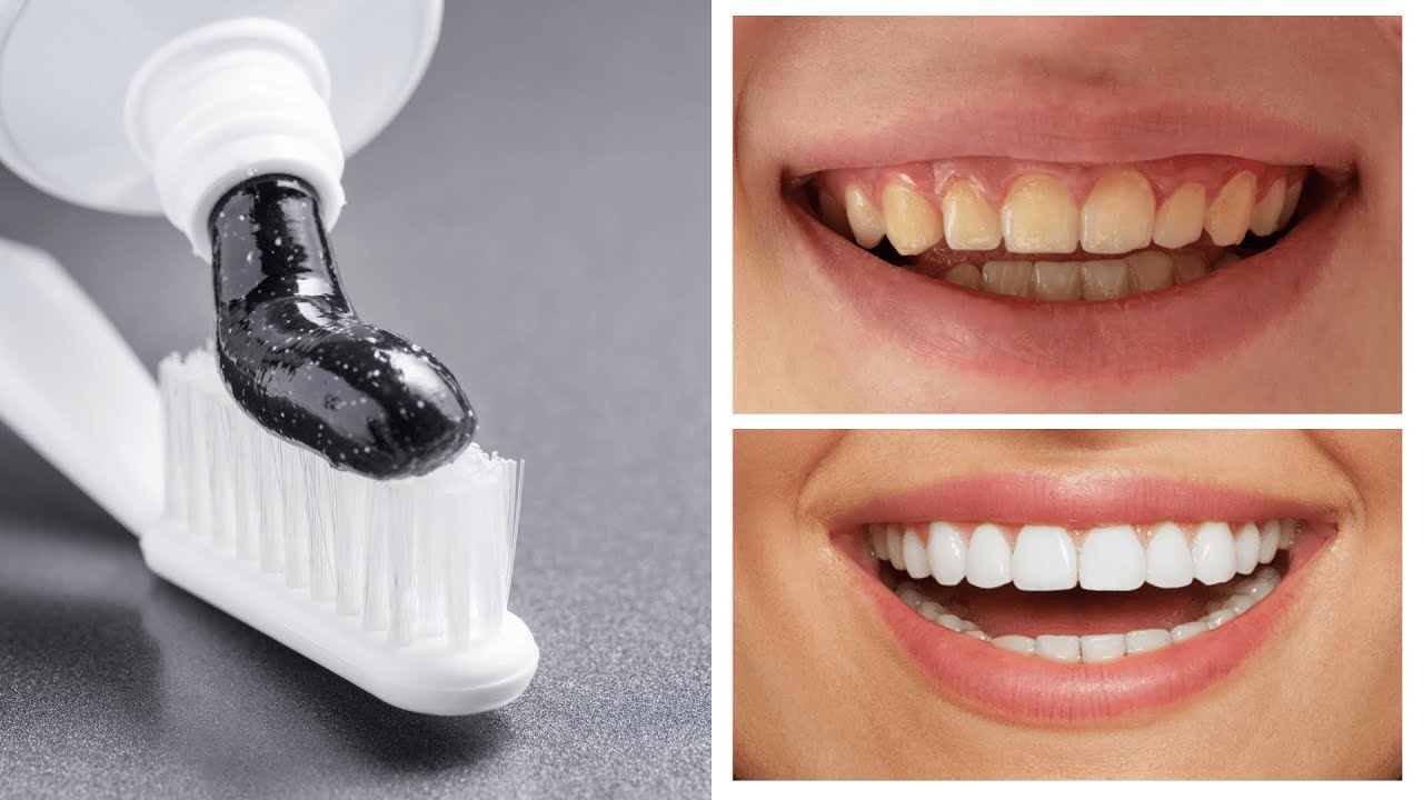 10 Infalíveis Maneiras Naturais De Branquear Os Dentes Em Casa - YouTube