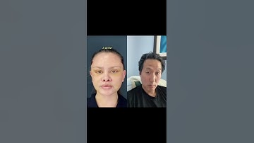 Plastic Surgeon Reacts to Extreme Plastic Surgery Makeover #shorts #plasticsurgery