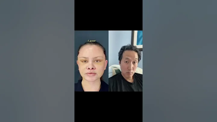 Plastic Surgeon Reacts to Extreme Plastic Surgery Makeover #shorts #plasticsurgery