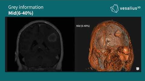 Vesalius3D Tutorial - MRI Visualizations