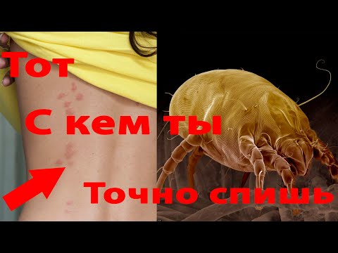 Невидимая опасность в вашей кровати. Откуда берется пылевой клещ|Как бороться с мелкими паразитами.