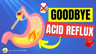 5 Ways to naturally stop ACID REFLUX | How to STOP Acid Reflux Instantly