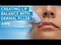 Balancing Out Lips with Top Lip Only Dermal Filler | AAFE