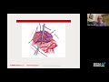 Arteriovenous Malformations - Philip E. Stieg, PhD, MD