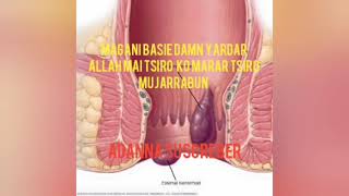 Magani basir kowani iri majarrabun dayardar allah Magani basir kowani iri majarrabun dayardar allah