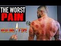 The WORST PAIN - Can FIRE CUPPING / Hijama Fix Muscle Injury??  (Lex Fitness Before & After Results)