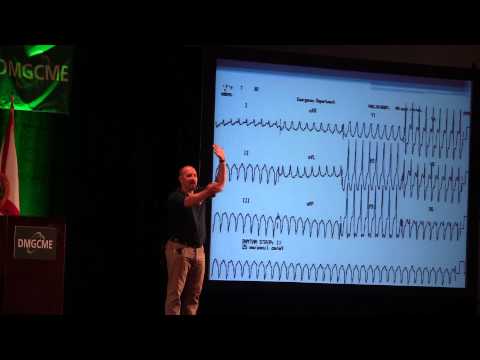 Understanding Ventricular Tachycardia