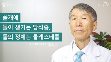 [황성수TV] 쓸개에 돌이 생기는 담석증, 돌의 정체는 콜레스테롤