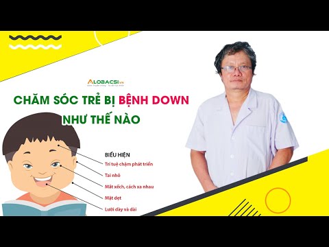 Chăm sóc trẻ mắc hội chứng Down như thế nào?