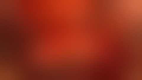 Implant placement and Vertical augmentation using layer to layer technique