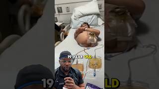 He Had Half His Body Amputated After a Workplace Injury #shorts