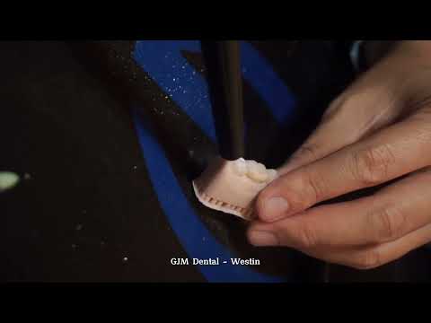 Hands On, menjadi salah satu kegiatan yang wajib diikuti oleh para dokter gigi untuk menambah skill