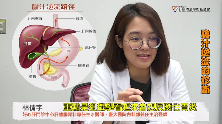 不只胃食道逆流 膽汁也會逆流？ - 天天要聞
