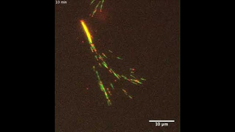 Fireworks! Self-organization of parallel microtubule bundle in vitro
