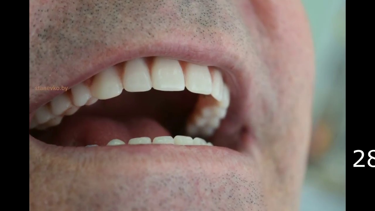 immediate load belarus