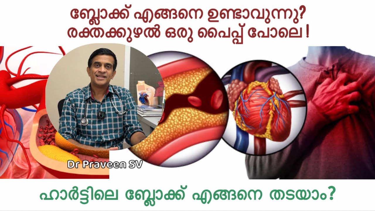 Heart block malayalam| ബ്ലോക്ക്‌ എങ്ങനെ ഉണ്ടാവുന്നു ? എങ്ങനെ തടയാം?  heart block maran malayalam|