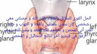 علاج سحري و مجرب لعلاج عقيدات الغده الدرقية