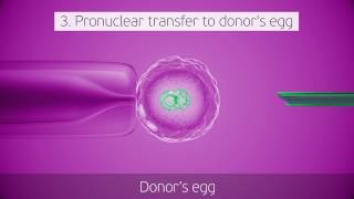 Pronuclear Transfer by Nadiya Clinic