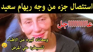 عاااجل:استئصال جزء من وجه ريهام سعيد ومعاناه كبيره  من الاطباء !!!!!!!!