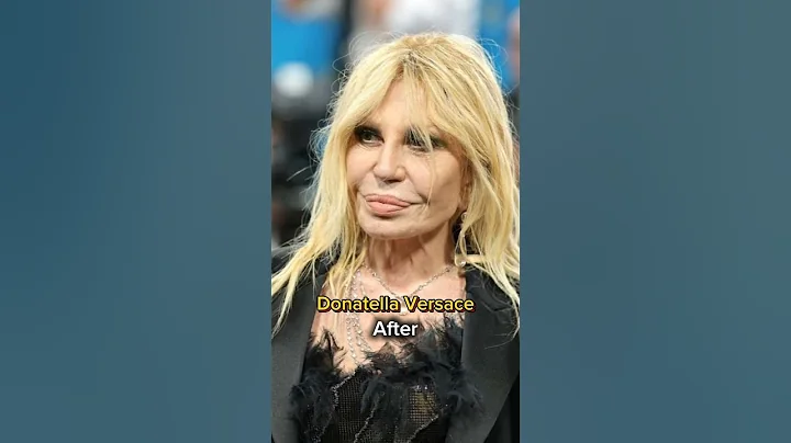 Celebrities Before vs After Surgery 👀 #shorts