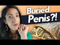 What to do if you can't see your penis?! | Buried penis