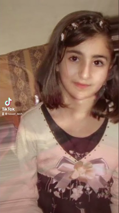 تعال شوف ديما بشار قبل و بعد 😂😂