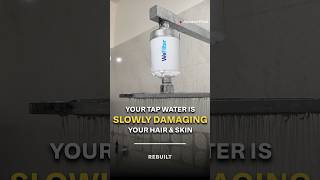 This ₹1,599 Tap Filter Fixes India's Hard Water Problem — Honest Review