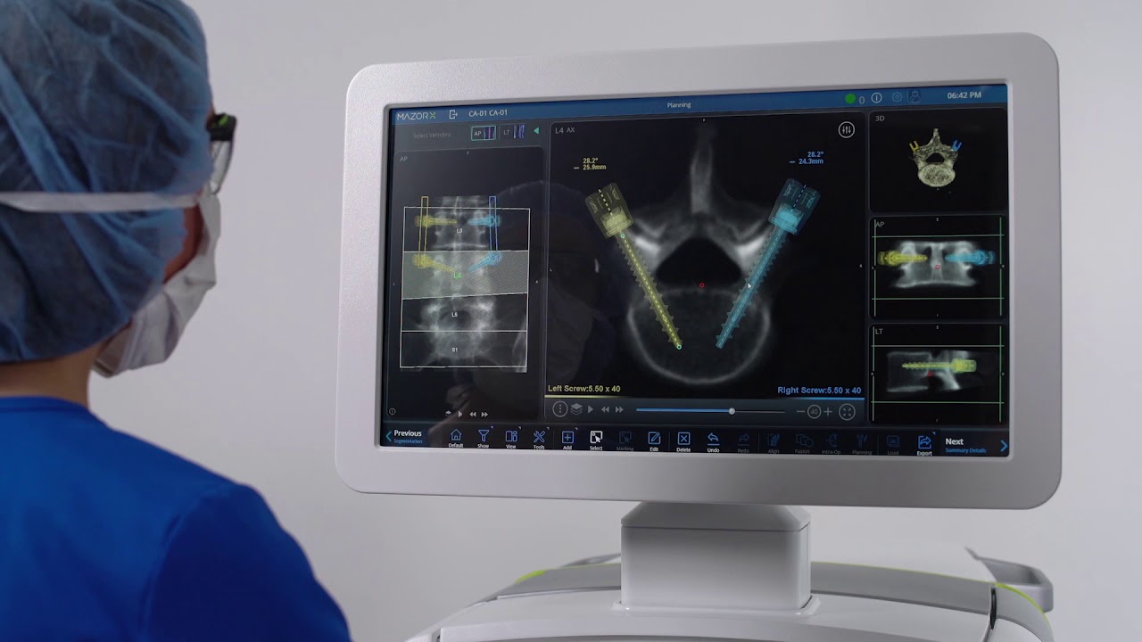 Mazor X Surgeon Planning Part 1 YouTube