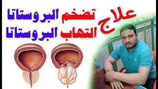 علاج تضخم والتهاب البروستاتا / الوقاية من الاصابة بالبروستاتا / حل مشاكل البروستاتا