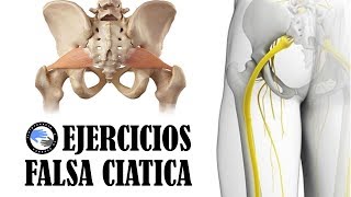 Dura falsa ciatica cuanto