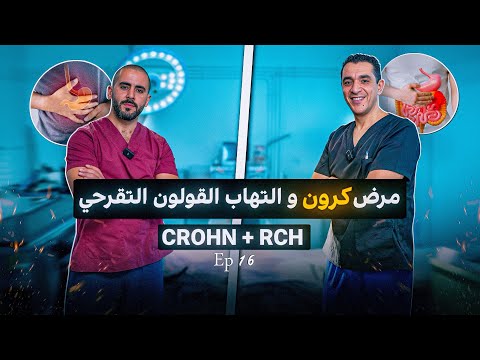 كرون و القولون التقرحي مع بروفيسور الصوفي Ep 16 NABADAT PODCAST