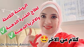 #شيرين_امين الروشتة الكاملة لعلاج القشرة الدهنية والاكزيما الدهنية