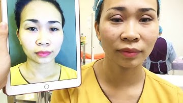 Mí Vừa Cắt Xong Tại VTM Dr.Hải Lê.