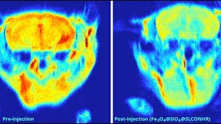 Dualmodal Nirfluorophore Conjugated Magnetic Nanoparticle For Imaging Amyloidβ Species In Vivo