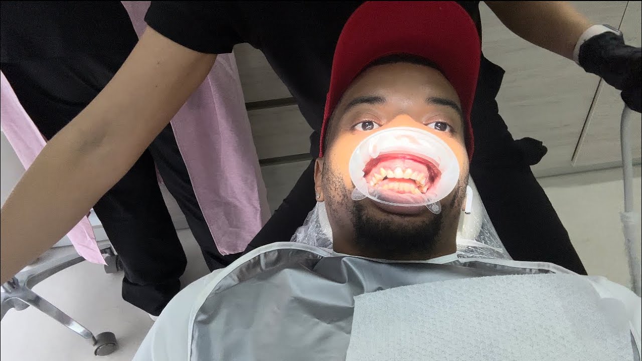 FLEW TO COLOMBIA BY MYSELF TO GET VENEERS!!!!