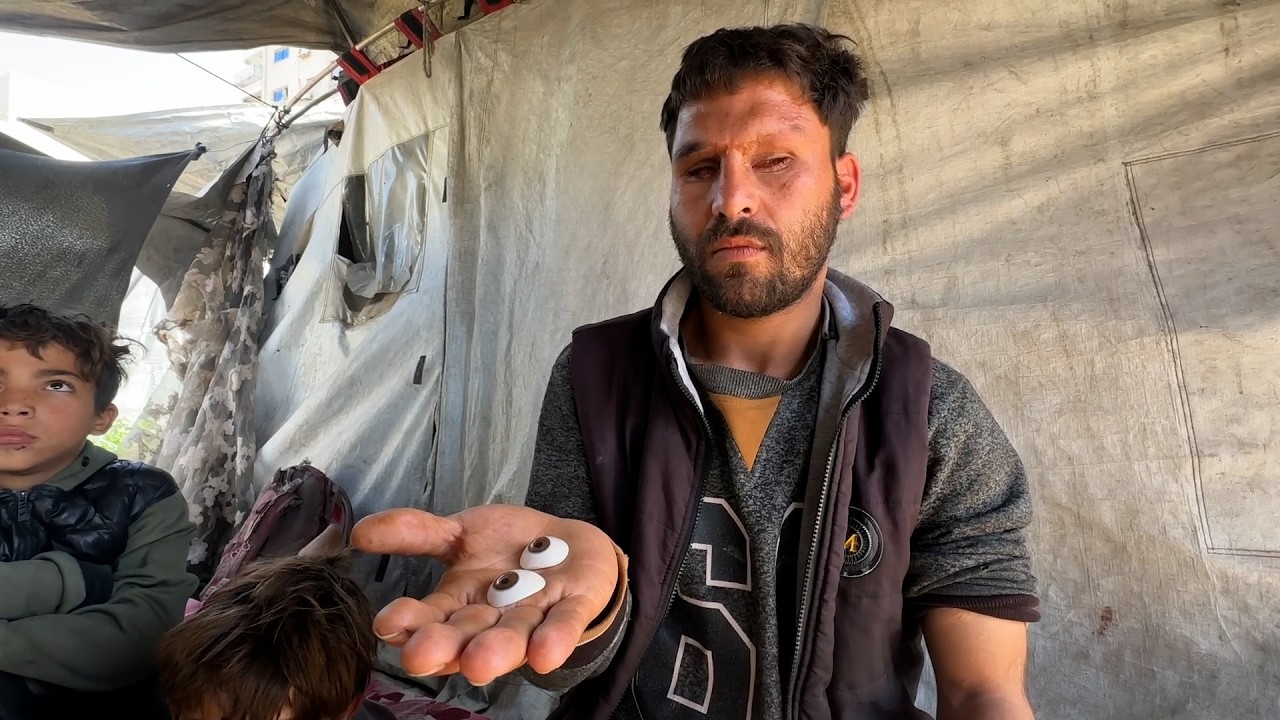 لؤي صبح فقد بصره وأُصيب بإعاقات دائمة جراء العدوان الإسرائيلي على غزة ويعيش مع أسرته في خيمة مؤقتة