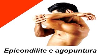 Epicondilite e agopuntura - rimedi epicondilite e gomito-  agopuntura a roma