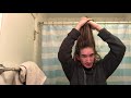 Men’s 15 Month Hair Growth Update !