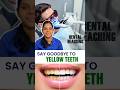 Teeth Whiteningக்கு 𝐁𝐥𝐞𝐚𝐜𝐡𝐢𝐧𝐠 தான் Best Option! | 𝐃𝐫.𝐍𝐞𝐞𝐦𝐳 𝐃𝐞𝐧𝐭𝐢𝐬𝐭𝐫𝐲🩺