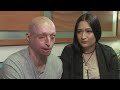 Acid victim finds love again with carer who nursed him