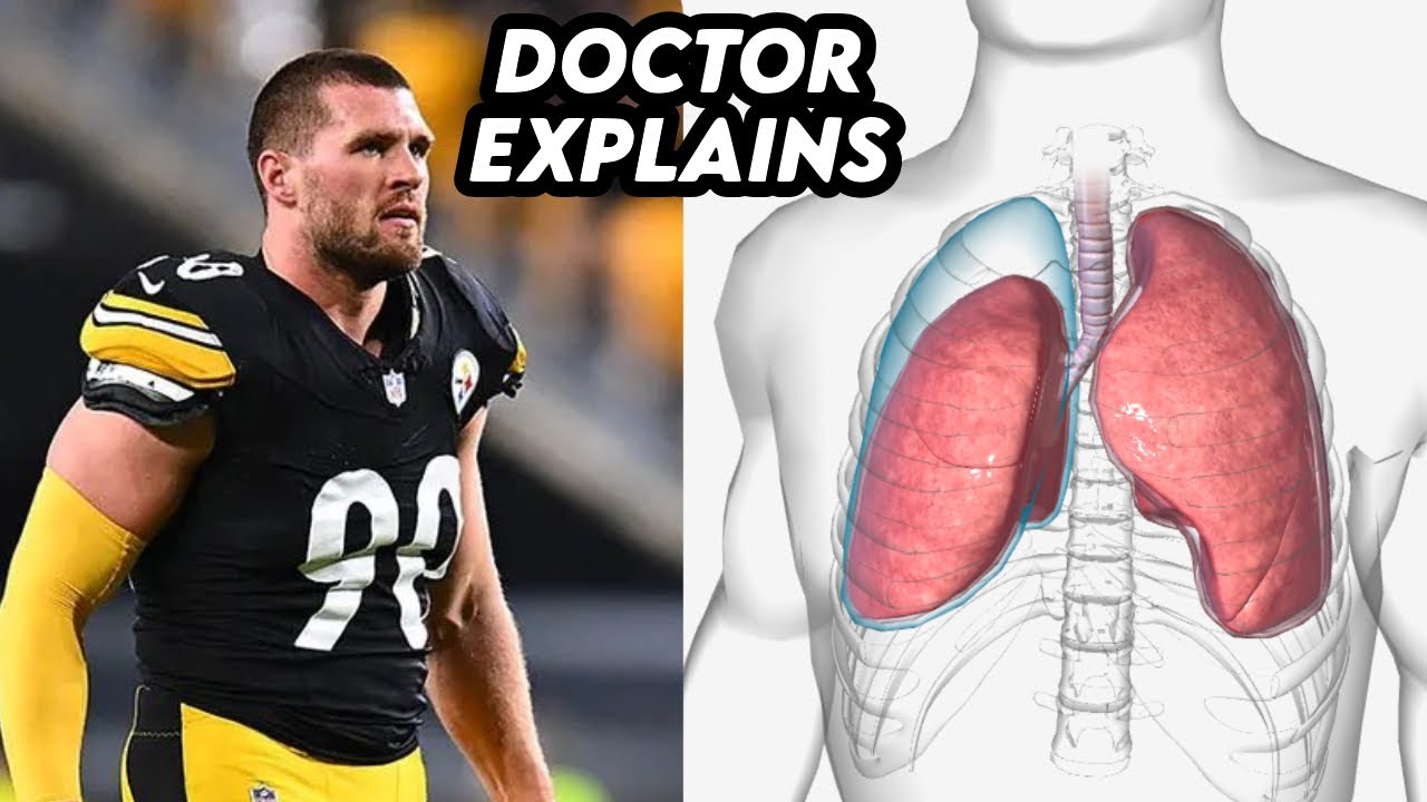 TJ Watt Lung Collapses From Rehab Treatment Complication - Doctor Explains