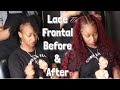 Client with THIN EDGES gets a PROTECTIVE Lace Frontal - Start to Finish