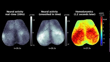 The Restless Brain: New Study Uncovers Vivid Patterns of Neural Activity in the Resting Mouse Brain