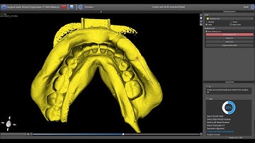 Complete Step by Step Process Flow For Patient CT and Impression CT