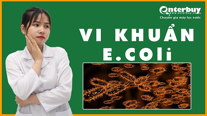 Ecoli vẩy khuẩn tả sống được ở bao nhiêu độ năm 2024