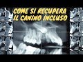 Come si recupera il canino incluso